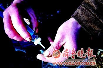 张勇的右手又红又肿。 